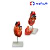 مولاژ قلب 1/5 برابر