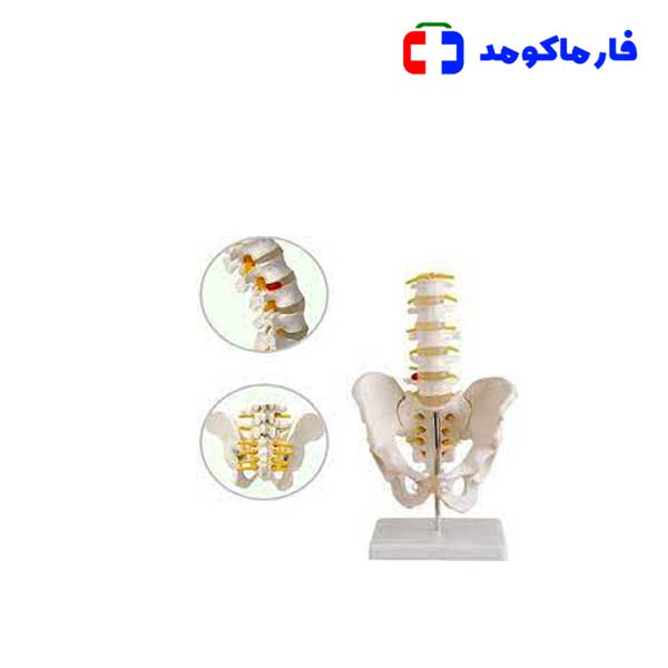 مولاژ لگن با 5 مهره مولاژ لگن با 5 مهره