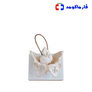 مولاژ لگن با سر نوزاد