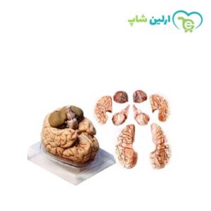 مولاژ مغز 8 قسمتی