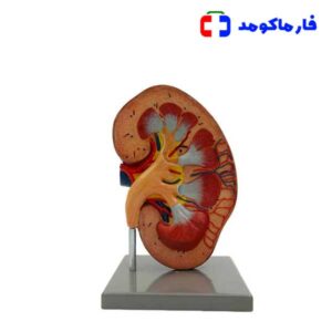 مولاژ کلیه ایستاده