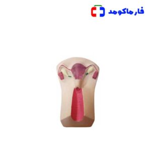 مولاژ ایودی گذاری