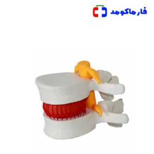 مولاژ مهره دیسک